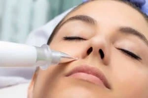 Best Actinic Keratoses Removal 3 Actinic keratoses Staveley solutions - book in today!